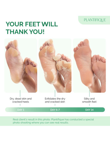 Mascarilla Exfoliante para Pies Plantifique 4 Paquetes - Suaviza y Repara