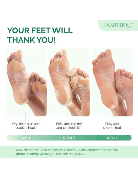 Mascarilla Exfoliante para Pies Plantifique 4 Paquetes - Suaviza y Repara