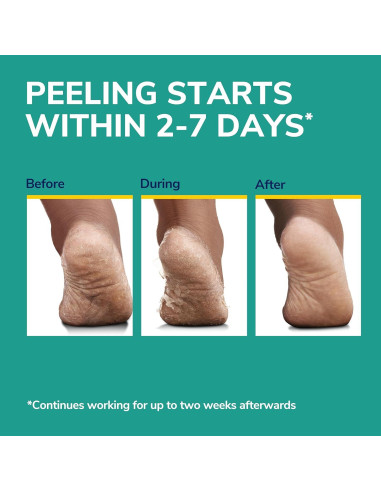 Máscara Exfoliante para Pies Dr. Scholl's - 3 Pares Hidratantes