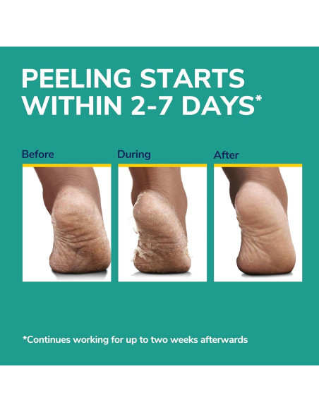 Máscara Exfoliante para Pies Dr. Scholl's - 3 Pares Hidratantes