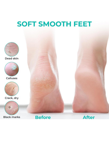 Máscara Exfoliante para Pies Happy Feet - 3 Paquetes, Limón