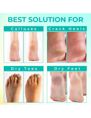 Máscara Exfoliante para Pies Happy Feet - 3 Paquetes, Limón