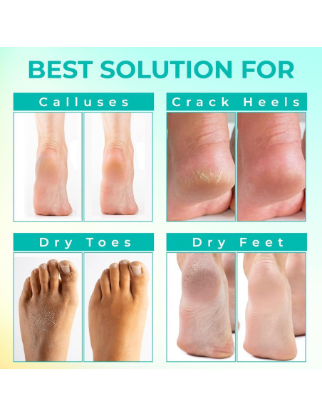 Máscara Exfoliante para Pies Happy Feet - 3 Paquetes, Limón