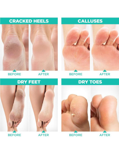 Máscara Exfoliante para Pies Lavinso - Paquete de 2 Aloe Vera