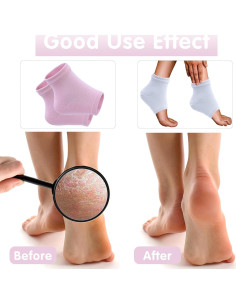 Calcetines Hidratantes para Talones Secos y Agrietados - 2 Pares 2