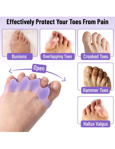 Separadores de Dedos de Gel Dr. JK ToePal - 2 Pares, Correctores de Juanete