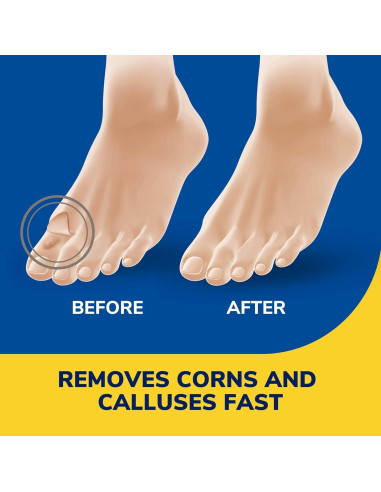 Remedio Líquido para Callos y Durezas Dr. Scholl 9.4 ml