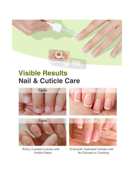 Aceite de Uñas y Cutículas EJW Camelia 14.79 ml - Hidratante Vegano