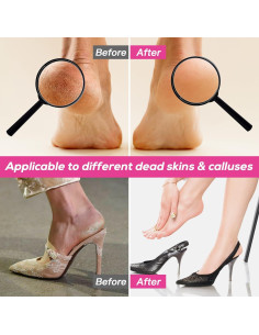 Lima de pies eléctrica KOYYTO con 60 discos de lija negra 2