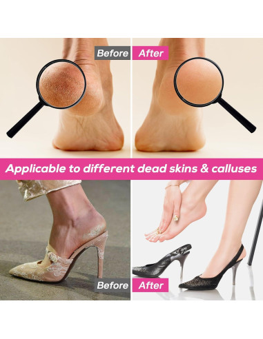 Lima de pies eléctrica KOYYTO con 60 discos de lija negra