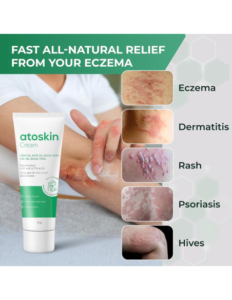 Crema Atoskin para Eczema y Dermatitis - 40.8 g