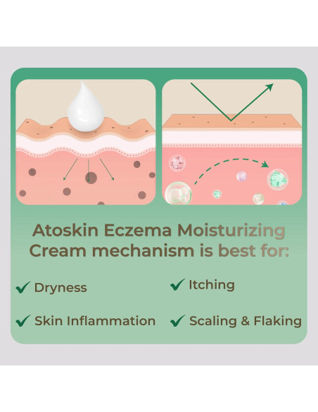 Crema Atoskin para Eczema y Dermatitis - 40.8 g