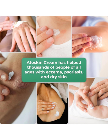 Crema Atoskin para Eczema y Dermatitis - 40.8 g