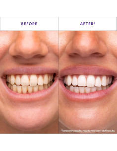 Tiras Blanqueadoras Hismile V34 - 14 Aplicaciones Efectivas 2