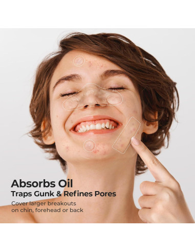 Parches Hidrocoloides para Nariz TKTK - 112 Piezas XL 91x48mm