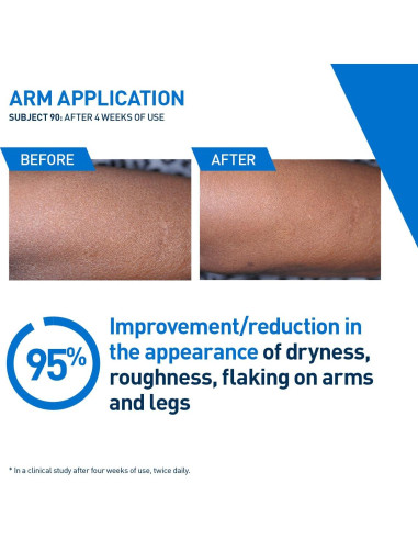 CeraVe Loción Hidratante Intensiva 236.6ml Hidro-Urea Manteca Karité