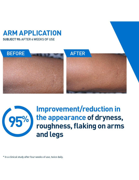 CeraVe Loción Hidratante Intensiva 236.6ml Hidro-Urea Manteca Karité