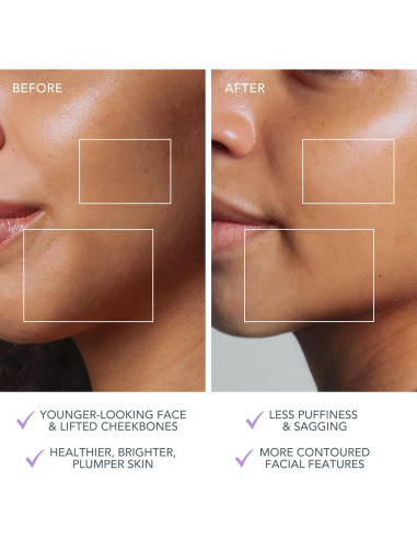 Dispositivo Facial Microcorriente FOREO BEAR 2 - Antienvejecimiento - Lavanda