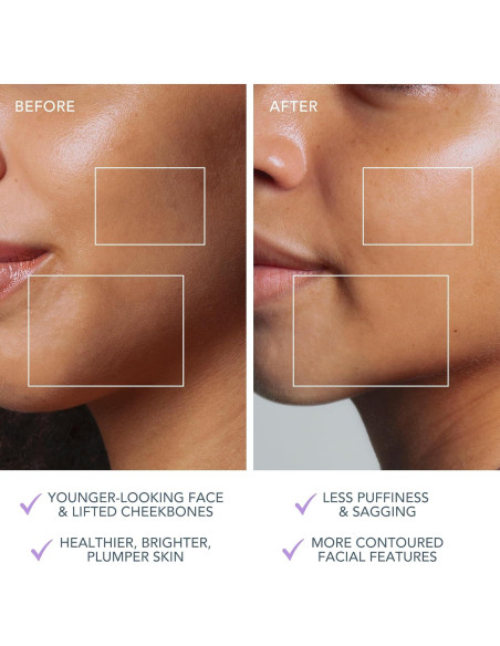 Dispositivo Facial Microcorriente FOREO BEAR 2 - Antienvejecimiento - Lavanda