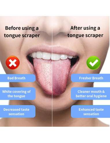 Cepillo de dientes eléctrico JTF azul con 6 cabezales y 5 modos