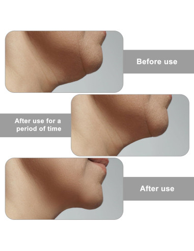 Correa de Nylon V-Line Lifting para Papada BOXOB - Ajustable