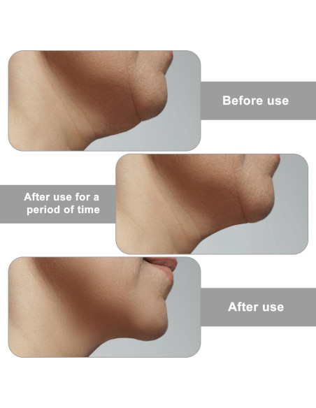 Correa de Nylon V-Line Lifting para Papada BOXOB - Ajustable