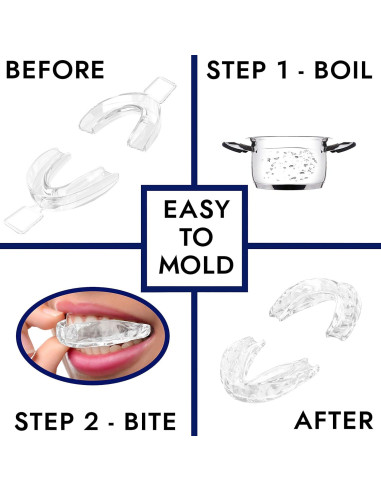 Bandejas Bucales Moldeables NovaWhite para Blanquear Dientes