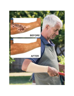 Janmercy 9 Pares Protectores de Brazo para Piel Delgada Beige 2