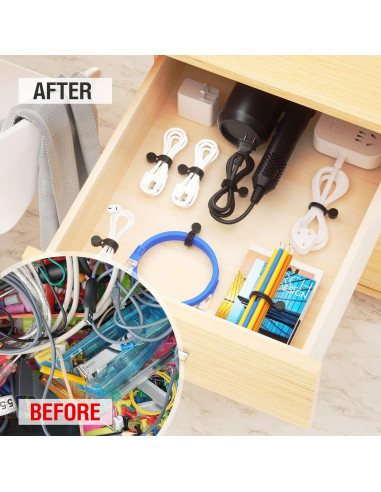 Correas Magnéticas Retorcidas FRKNER 8 Paquetes Silicona