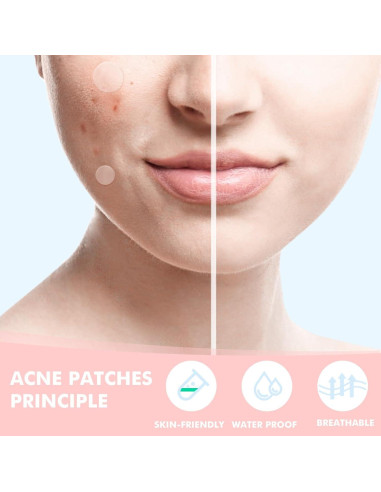 Parche para Granos Hidrocoloide Sundpik 304 Unidades