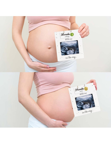 Marco de Ultrasonido BUULUE para Seguimiento del Embarazo