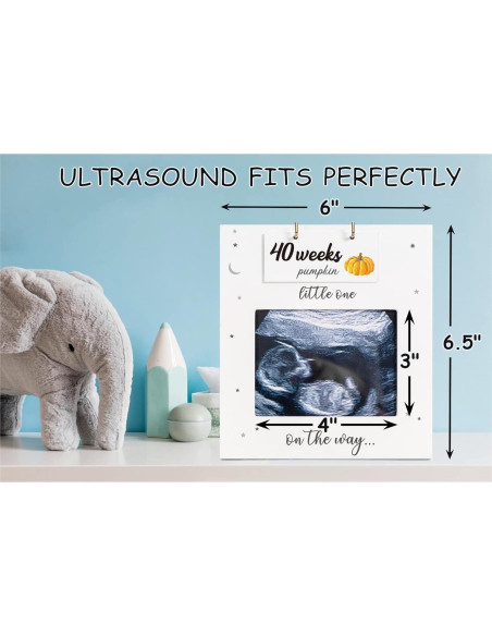 Marco de Ultrasonido BUULUE para Seguimiento del Embarazo Marco de Ultrasonido BUULUE para Seguimiento del Embarazo