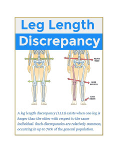 Plantillas para Fascitis Plantar YouthBelief - Soporte Arco 2 Pares 2