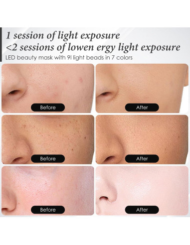 Máscara de Luz LED Rosa SDKWDH para Cuidado Facial 7 Colores