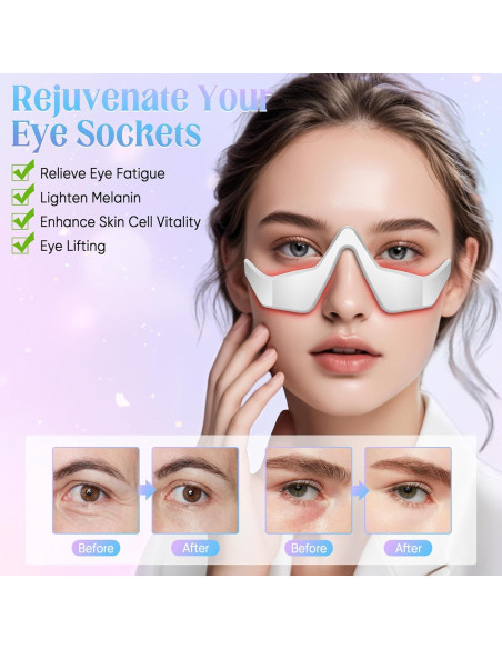 Masajeador Ocular Nienele con Terapia de Luz - Alivio Fatiga Ocular