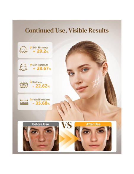 Máscara de Terapia de Luz Roja Lanieney Inalámbrica 4 Modos