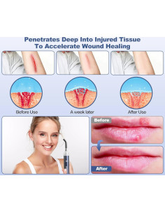 Dispositivo de Terapia de Luz Roja Aswaysun 2 en 1 para Alivio del Dolor 2