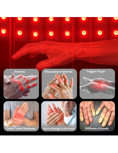 Guante Terapia Luz Roja Inalámbrico PEEWF para Manos - Alivio Artritis 2