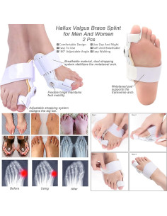 Kit Corrector de Juanetes Gelmay 15 Piezas Alivio Hallux Valgus 2