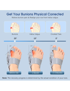 Corrector de Juanetes KASHEVI Ajustable para Alivio del Dolor 2