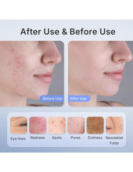 Máscara de Terapia de Luz LED Hello Face M500 para Acné y Arrugas