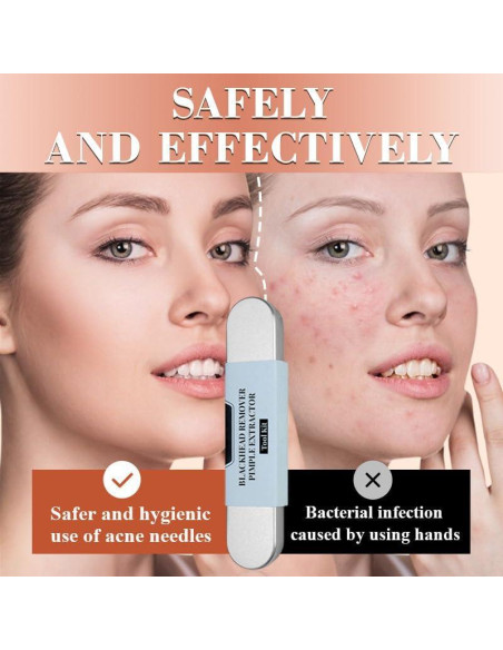 Kit de Herramientas Aocesk para Remoción de Puntos Negros - 7 Piezas