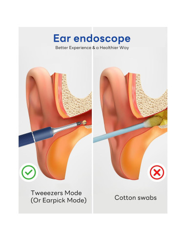 Kit de Eliminación de Cera de Oído MEKK S5 - Visual HD 1080P