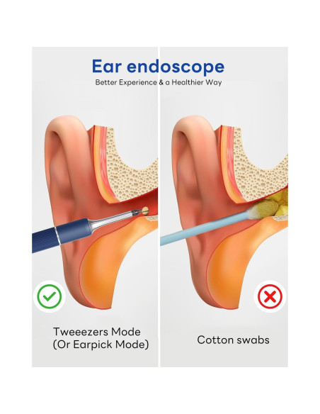 Kit de Eliminación de Cera de Oído MEKK S5 - Visual HD 1080P