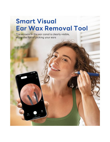 Kit de Eliminación de Cera de Oído MEKK S5 - Visual HD 1080P