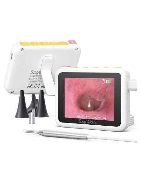 Otoscopio Digital ScopeAround HD 720P con Luz - 3.9mm