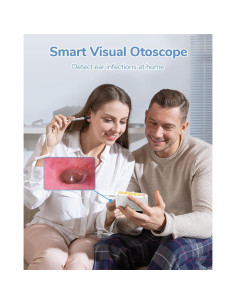 Otoscopio Digital ScopeAround HD 720P con Luz - 3.9mm 2