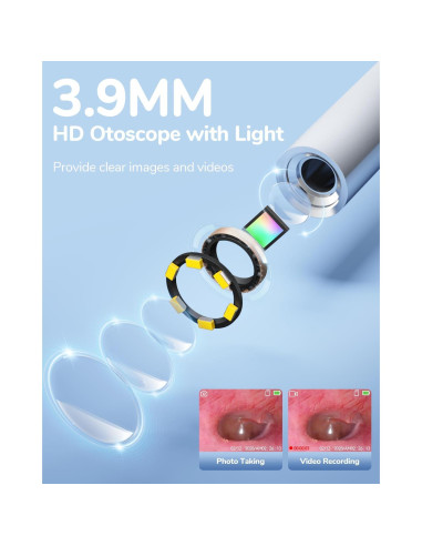 Otoscopio Digital ScopeAround HD 720P con Luz - 3.9mm