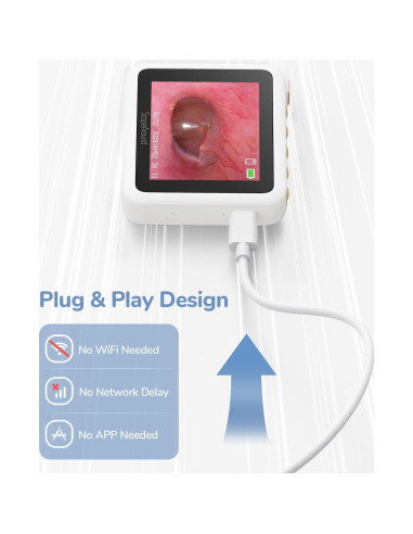 Otoscopio Digital ScopeAround HD 720P con Luz - 3.9mm