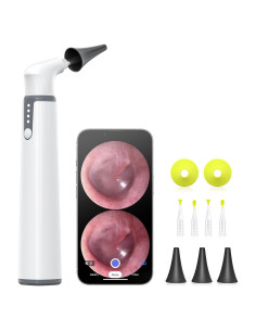 Otoscopio Inalámbrico AnyScope con Cámara y Luz 3.9mm